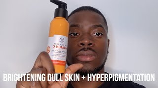 HOW I GOT RID OF DARK SPOTS BRIGHTEN DULL SKIN  HYPERPIGMENTATION [upl. by Caril]