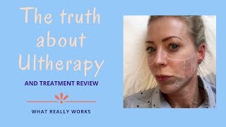 The truth about Ultherapy  Alice HartDavis [upl. by Karas632]