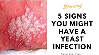 5 Signs You Might Have a Yeast Infection [upl. by Walrath]