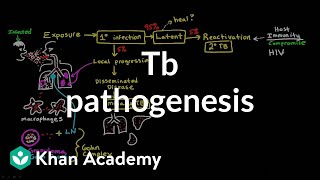 TB pathogenesis  Infectious diseases  NCLEXRN  Khan Academy [upl. by Enilrahc]