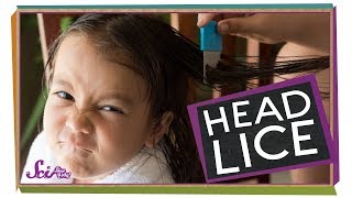 The Head Lice Lifecycle [upl. by Ahilam179]