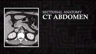 CT Cross Sectional Anatomy Abdomen Axial View [upl. by Ruomyes]