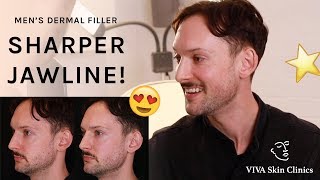 Creating A Sharper Jawline With Dermal Fillers  Mens Jawline Enhancement VIVA Skin Clinics London [upl. by Leinahtan]