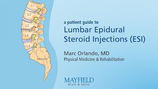 Lumbar Epidural Steroid Injections [upl. by Eivi]