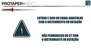 Sequência técnica da instrumentação rotatória [upl. by Norvan]