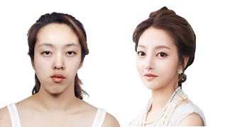 Top 5 Drastic Korean Plastic Surgery TV Show Transformations  Seoul Guide Medical [upl. by Huff74]