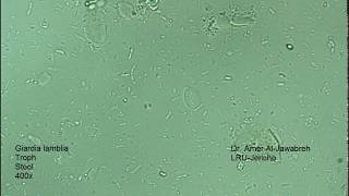 Giardia lamblia intestinalis trophozoite [upl. by Nagram]