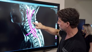 Symptoms of Cervical Stenosis  Jeffrey Cantor MD [upl. by Enotna]