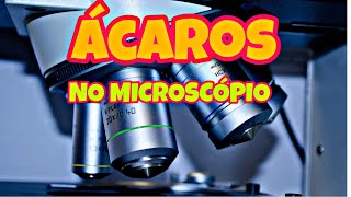 ÁCAROS NO MICROSCÓPIO VÍDEO INCRÍVEL [upl. by Lenhard293]