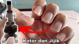 Kuku Panjang dan Kotor  Dirty Nail Under Microscope [upl. by Ytsim]