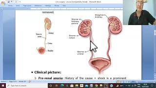 Urosurgery in Arabic 17 Anuria  part 1   by Dr Wahdan [upl. by Navac264]