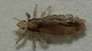 What Are Lice and Where Do They Come From [upl. by Ranger]