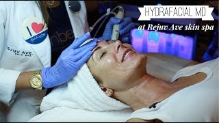 HydraFacial MD  TUTORIAL amp THOUGHTS [upl. by Lind]