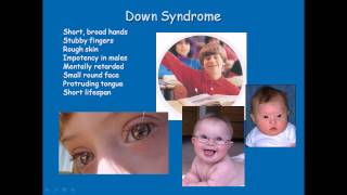 Chromosomal disorders [upl. by Mahala]