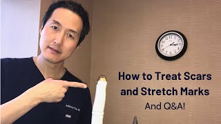 How to Treat Scars and Stretch Marks  Dr Anthony Youn [upl. by Asirak]