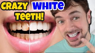 Get CRAZY WHITE Teeth  Best Teeth Whitening Products That Work  Chris Gibson [upl. by Sneed25]