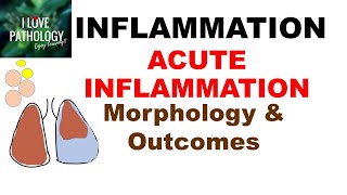 INFLAMMATION Part7 MORPHOLOGY amp OUTCOMES of Acute Inflammation [upl. by Eidnac]