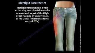 Meralgia Paresthetica  Everything You Need To Know  Dr Nabil Ebraheim [upl. by Tirreg]