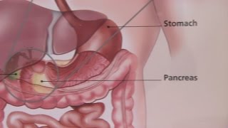 How to read a CT  Approach to Running Bowel [upl. by Ecnesse]