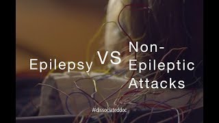 EPILEPSY Made Easy  TypesClassification and Diagnosis [upl. by Ramalahs]