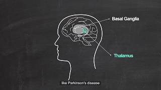 Thalamic Mechanism of Parkinson Disease [upl. by Janis131]