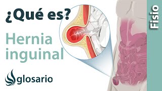 HERNIA INGUINAL  Qué es qué afecta síntomas  causas y tratamiento fisioterapéutico [upl. by Aiderfla]