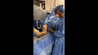 JONES FRACTURE SURGERY TECHNIQUE  Dr Sarang Desai [upl. by Madox276]