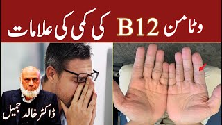 Vitamin B12 Deficiency and Symptoms  Lecture 204 [upl. by Haimorej]