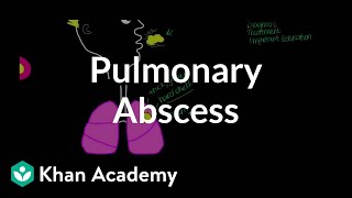 Advice for Living with Pulmonary Fibrosis [upl. by Nwahsd]