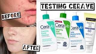 TESTING CERAVE FOR A MONTH FOR ACNE  ACNE SCARRING [upl. by Saxon702]