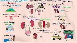 Polycythemia  Part 2 [upl. by Marcella212]