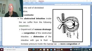 Hernia in Arabic 6  Strangulated hernia  part 1  by Dr Wahdan [upl. by Shrier]