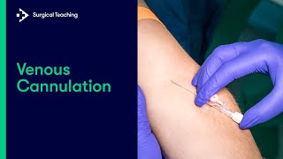 Cannulation How to gain IV access [upl. by Kyriako]