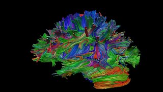 Networks in the brain mapping the connectome [upl. by Alissa]