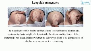 Leopolds maneuvers [upl. by Britt]