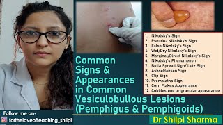 Signs in common Vesiculobullous Lesions Pemphigus amp Pemphigoids [upl. by Dopp]