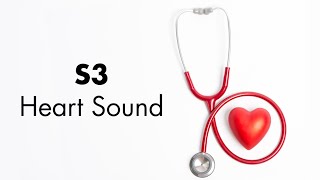 S3 Heart Sound  MEDZCOOL [upl. by Abe]