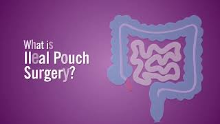 What is Ileal Pouch Surgery [upl. by Ayotyal519]