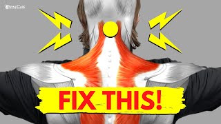 5 Neck Exercises At Home No Weights Or Machines [upl. by Osric]