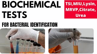 Biochemical Tests for Bacterial Identification Part1TSI MIU MRVP Lysin Urea Citrate [upl. by Karrah]