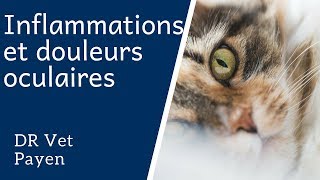 Inflammations et douleurs oculaires [upl. by Ahsiuqal11]