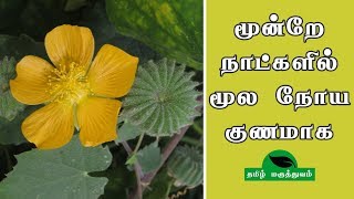 மூன்றே நாட்களில் மூல நோய் குணமாக  Thuthi ilai uses in Tamil  Abutilon Indicum for Piles [upl. by Anaeerb]