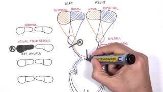 Visual Pathway and Lesions [upl. by Connel]