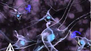 Demyelinating Diseases  Neurology Case Study  VLearning  sqadiacom [upl. by Arraek45]