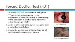 DMEK Descemets membrane endothelial keratoplasty animation [upl. by Eednar353]