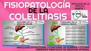 COLELITIASIS FISIOPATOLOGÍA GuiaMed [upl. by Arliene]