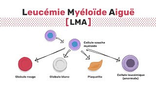 Types de leucémie myéloïde aiguë [upl. by Kumagai]