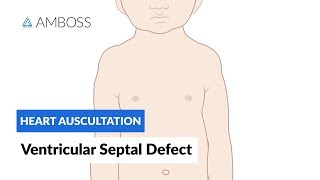 Ventricular Septal Defect VSD  Heart Auscultation  Episode 11 [upl. by Ihpen]