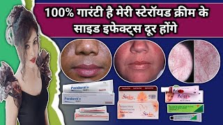 How To Remove Steroids Cream Side Effects Steroids Cream Ke Side Effects Kaise Door Kare [upl. by Ahsekram559]