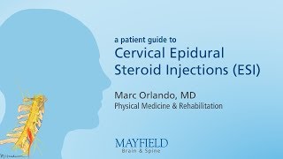 Cervical Epidural Steroid Injection [upl. by Perlie136]